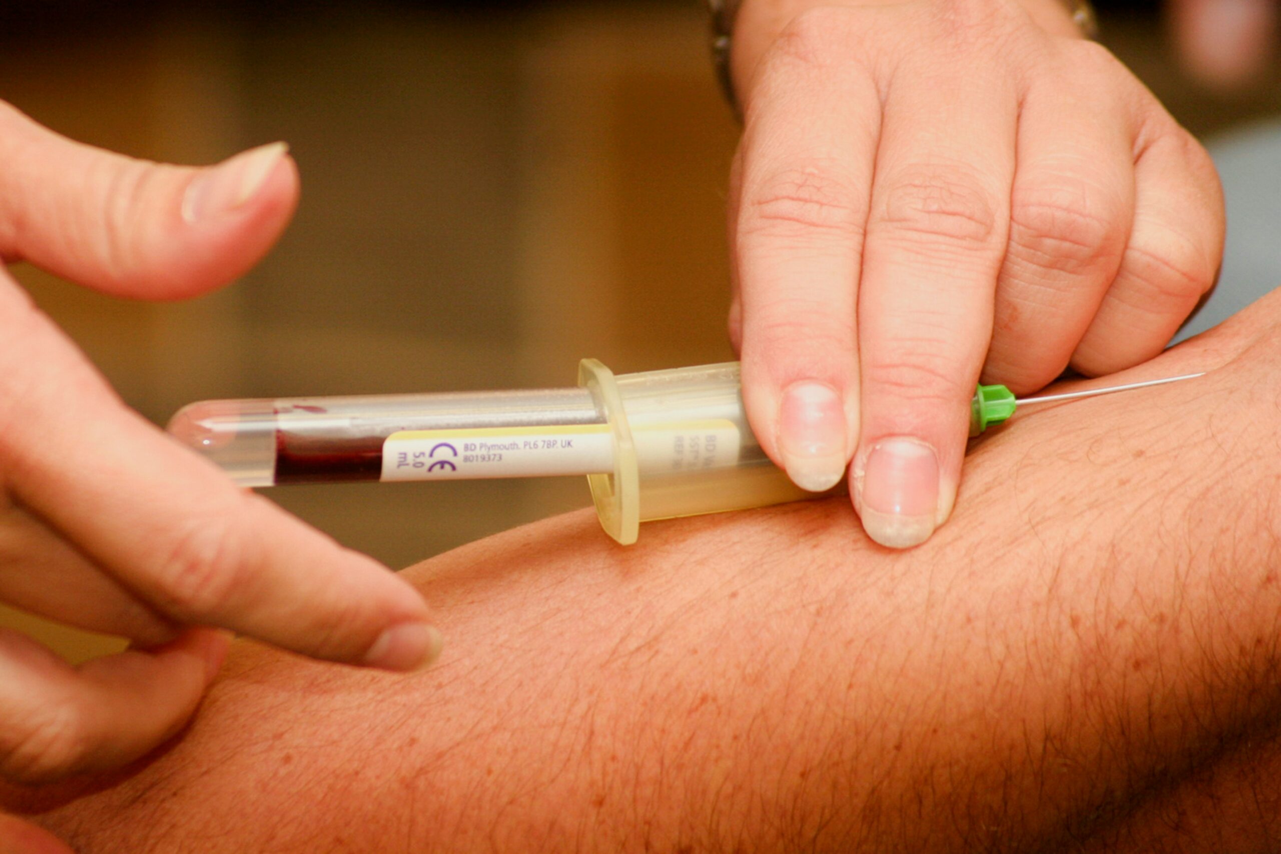 A phlebotomist takes a blood test to check sodium levels.